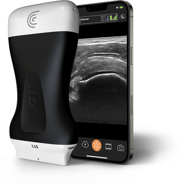 Clarius L15 HD3 handheld ultrasound scanner for MSK imaging