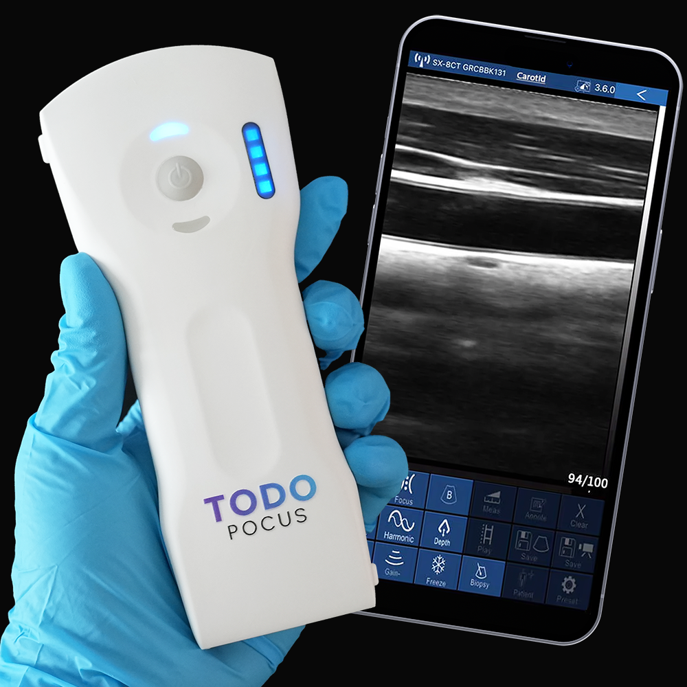 TodoPocus L10H-Guide handheld ultrasound with needle visualization